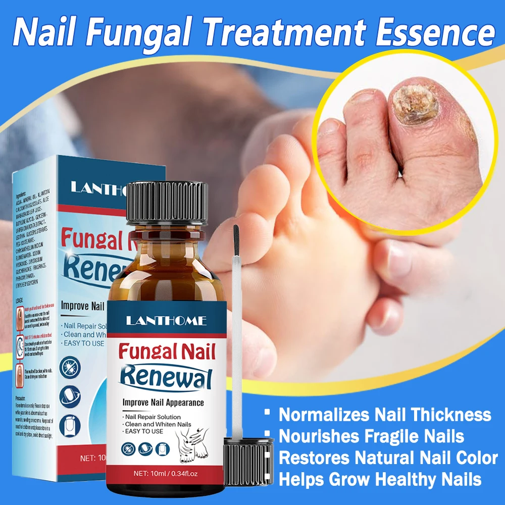 

1-10pcs Repair Nail Fungal Treatmen Essence oil Anti Infection Onychomycosis Removal Toe Nail Foot Fungus Paronychia Nail Fungu