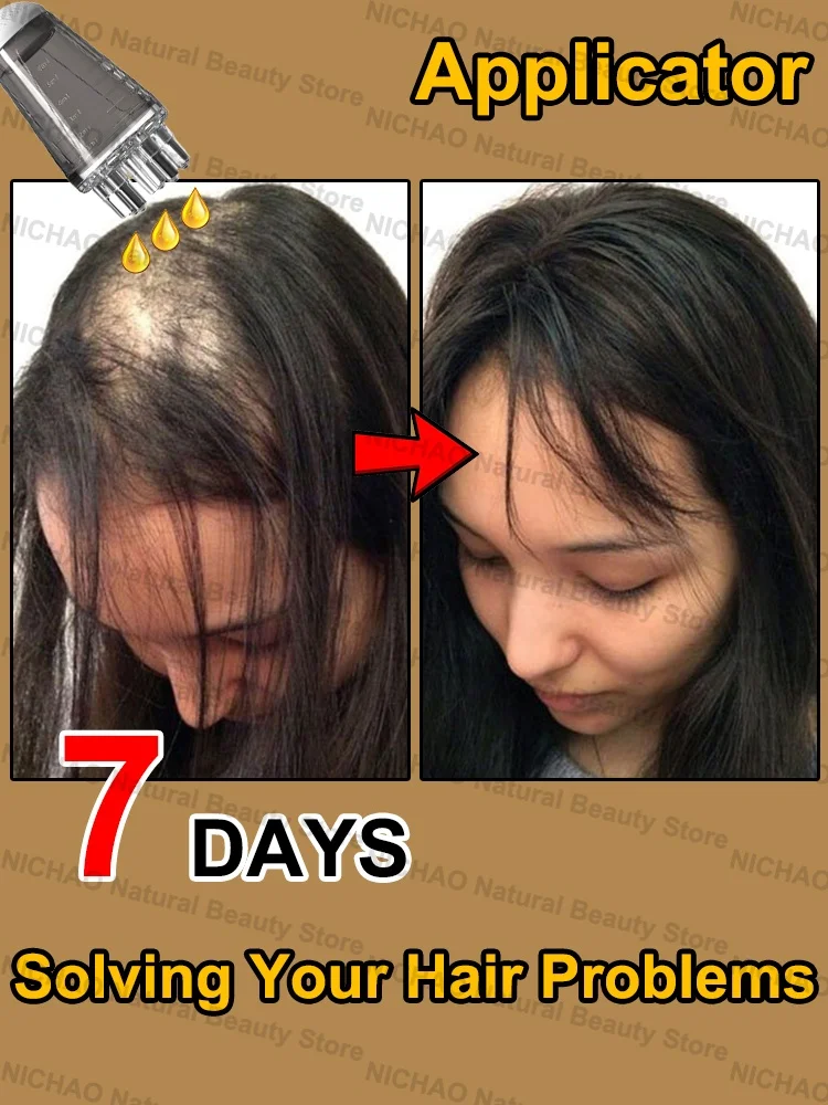 

7 Days Fast Hair Growth Essential Loss Regrowth Treatment Strengthens Hair Nourishes Scalp Light Weight Non Greasy