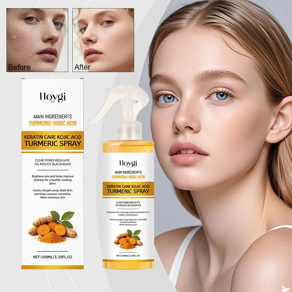 Spray złuszczający z kwasem kojowym i kurkumą, usuwający martwy naskórek, nawilżający, oczyszczający, pielęgnujący, do twarzy i ciała, głęboko nawilżający, czyszczący spray O4L8