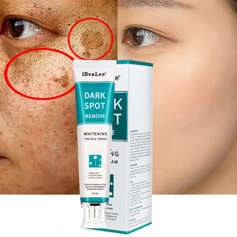 

Whitening And Freckle Removal Cream Brightens Skin Lightens Spots Reduces Roughness Dullness Restores Face Cream