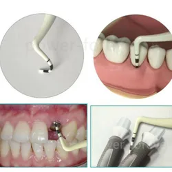 1 ~ 5 sztuk żywicy dentystycznej sonda do badania głębokości nie szkodzi implanty rozmiar 2-4-6-8-10