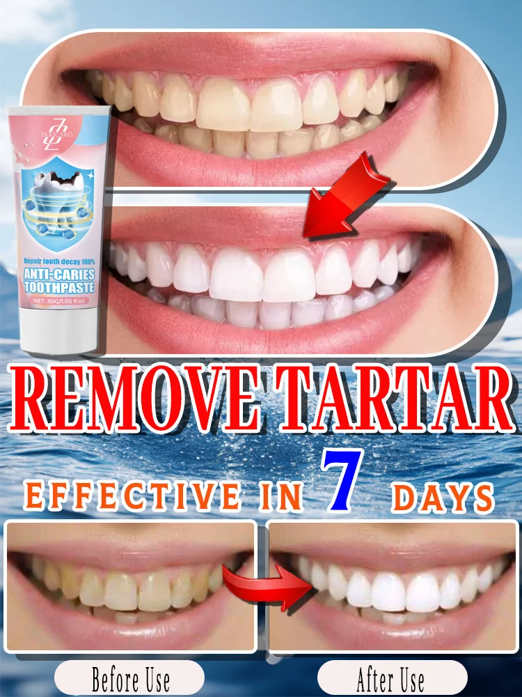 In just a few days, you can get rid of tooth decay and tartar problems