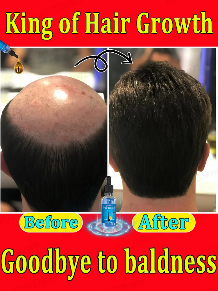 Hair growth essential oil, effectively repair baldness and hair loss, new hair growth