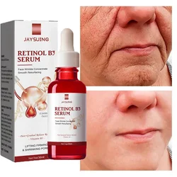 Retinol środek do usuwania zmarszczek serum do twarzy natychmiastowy ujędrniający Lifting Anti-Aging płyn znikną drobne linie wybielanie koreańskie produkty do pielęgnacji skóry