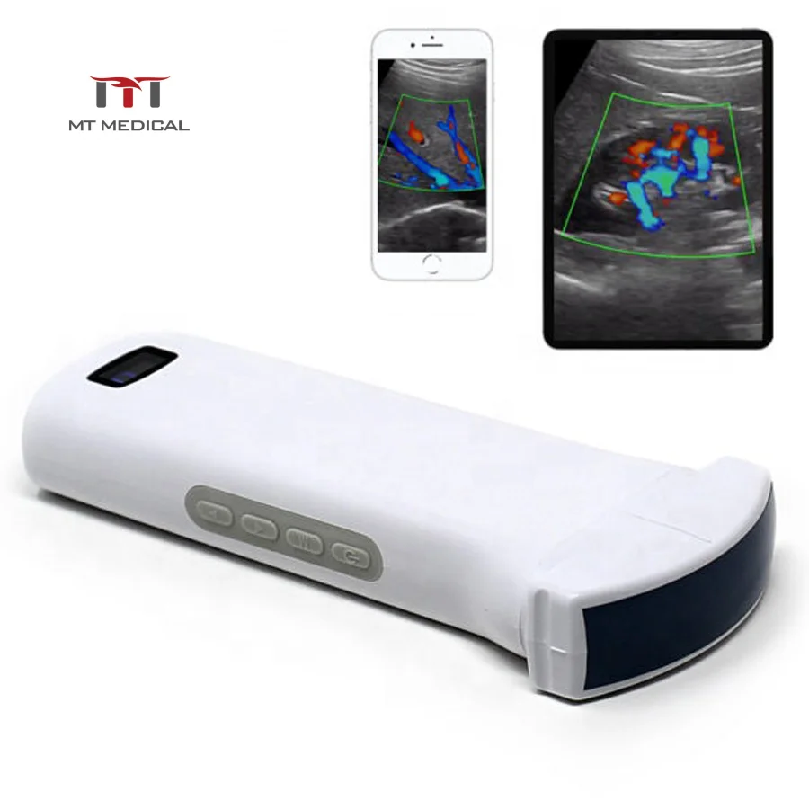 MT MEDICAL 3 In 1 Wireless Bladder Ultrasound Wireless Probe Scanner Dual Head Scanner Machine Cheap Priced