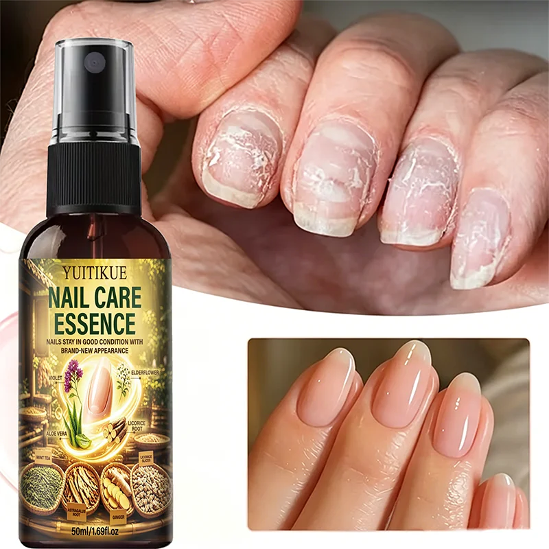 Natural Nail Repair Essence Spray Hydrating Smoothing Nourish Damaged Nails Improve Rough Nail Household Nail Care Spray