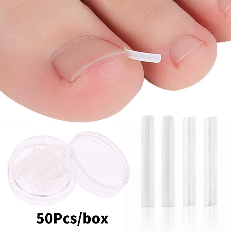 Herramienta de corrección de uñas encarnadas, parche elástico para tratamiento de uñas encarnadas, pegatina, Clip de alisado, Brace, pedicura, 50 piezas