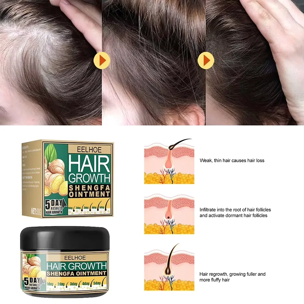 30g Ginger Hair Growth Cream Scalp Care Hair Regrowth Treatment Anti Hair Loss Nourishing Hair Root Repair Men Women Daily Care