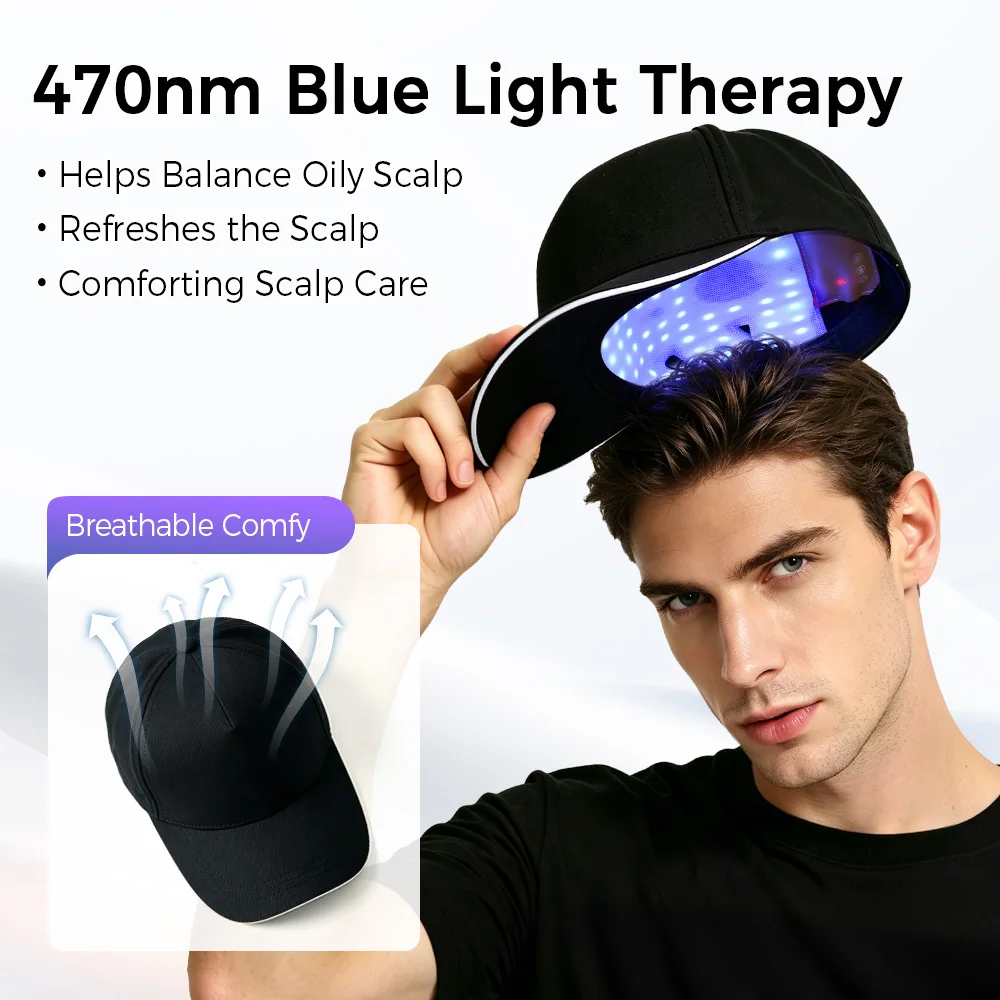 Thumbnail 4 - #16 Compare Hair Loss Treatments Before You Buy