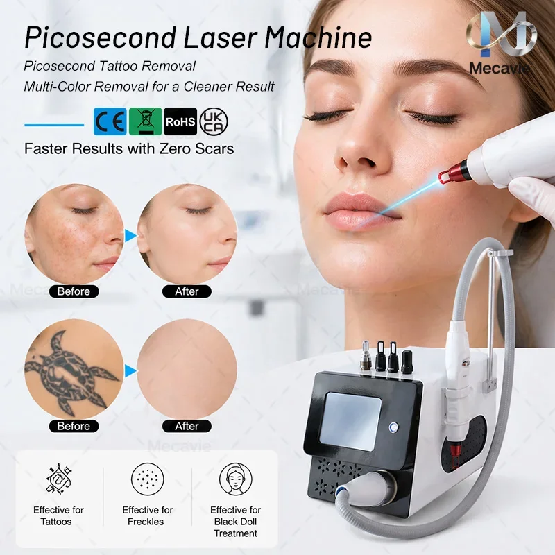 Meilleure machine laser Q-Switched ND Yag pour l'élimination des tatouages, 755nm 1064nm 532nm 1320nm, machine laser Pico pour éclaircir les taches de rousseur et renouveler la peau