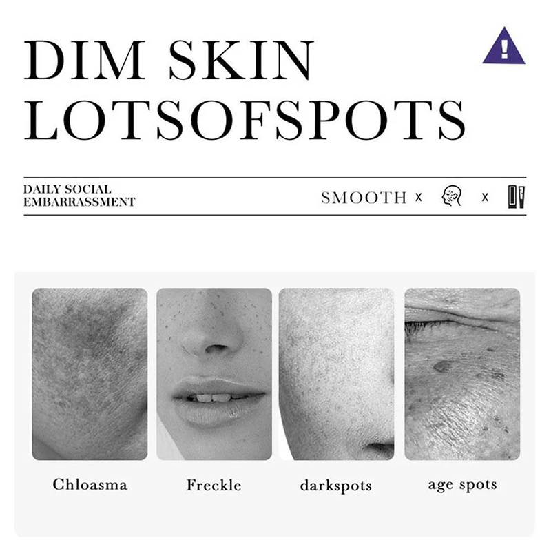 3 szt. 20g zioła Yunnan potężny wybielający krem z piegami usuń trądzik plamy ciemne plamy twarz nawilżający pielęgnacja skóry twarzy uroda