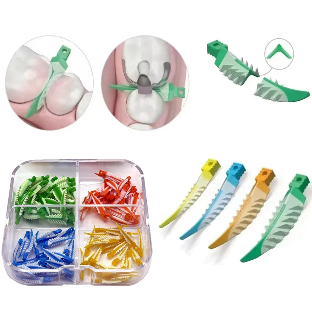

100Pcs Dental Silicone Interdental Wedges Kit Autoclavable Adaptive Matrix Wedges for Composite Restorations