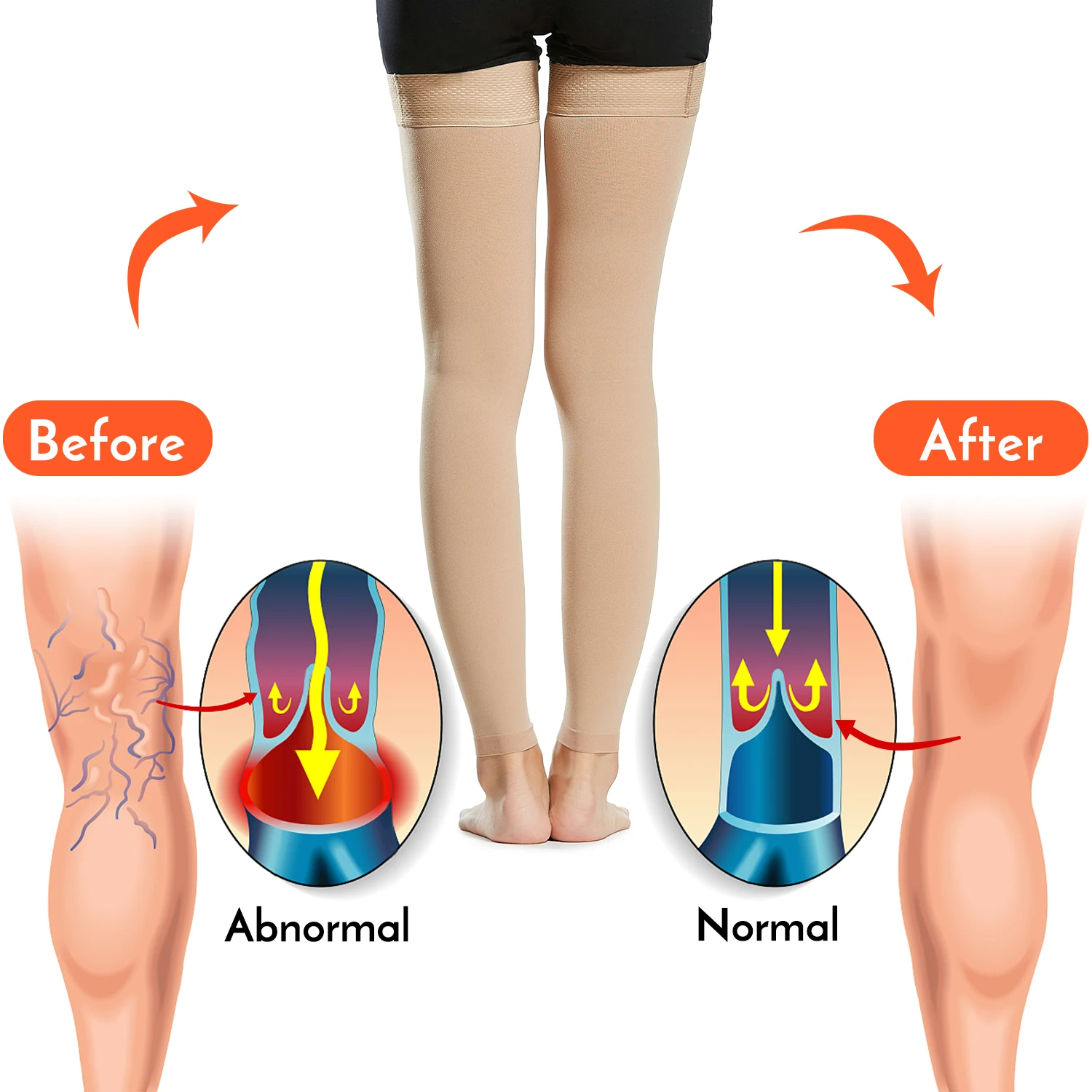 20-30mmHg 4XL 5XL Large Men 1Pair High Thigh Compression Socks For Varicose Vein Swelling Women Stockings Open Toe Black