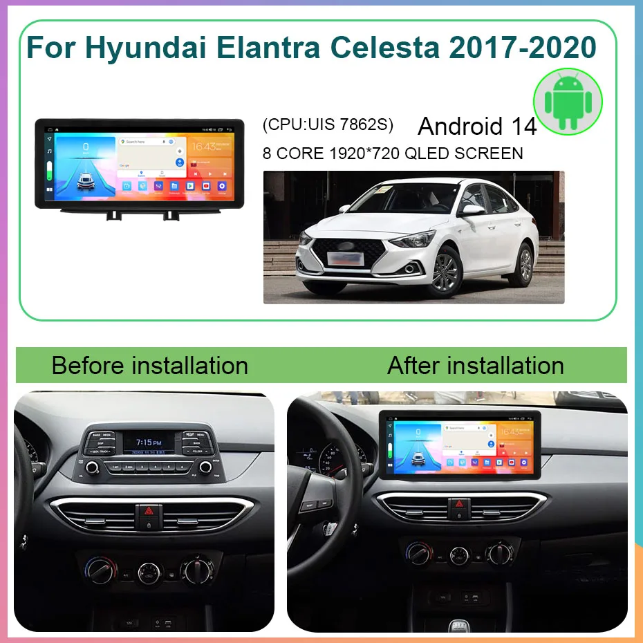 Android 14 8+256GB Wireless Carplay Car Radio For Hyundai Elantra Celesta 2017-2020 Multimedia Player Head Unit GPS Navigation