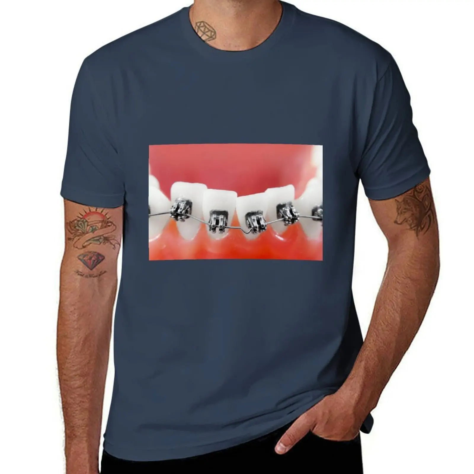 

Dental braces T-Shirt Basic Casual Short Sleeve Cotton Shirt