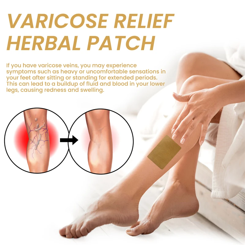 Effective Varicose Vein Relief Sticker Eliminate Vasculitis Phlebitis Spider Legs Treatment Soothing Relieve Pain Herbal Patches