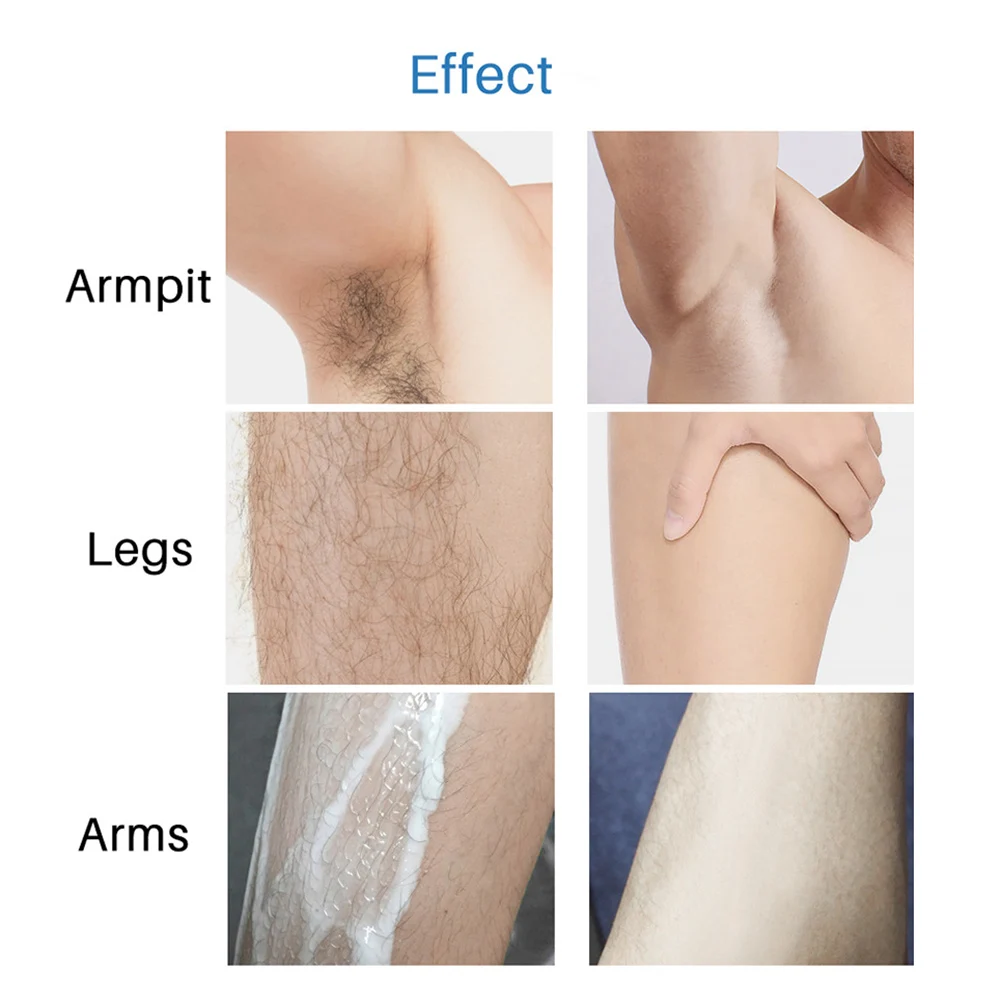 30ml Powerful Permanent Painless Hair Removal Spray Ant Snake Oil Stop Growth Inhibitor Shrink Pores Skin Smooth