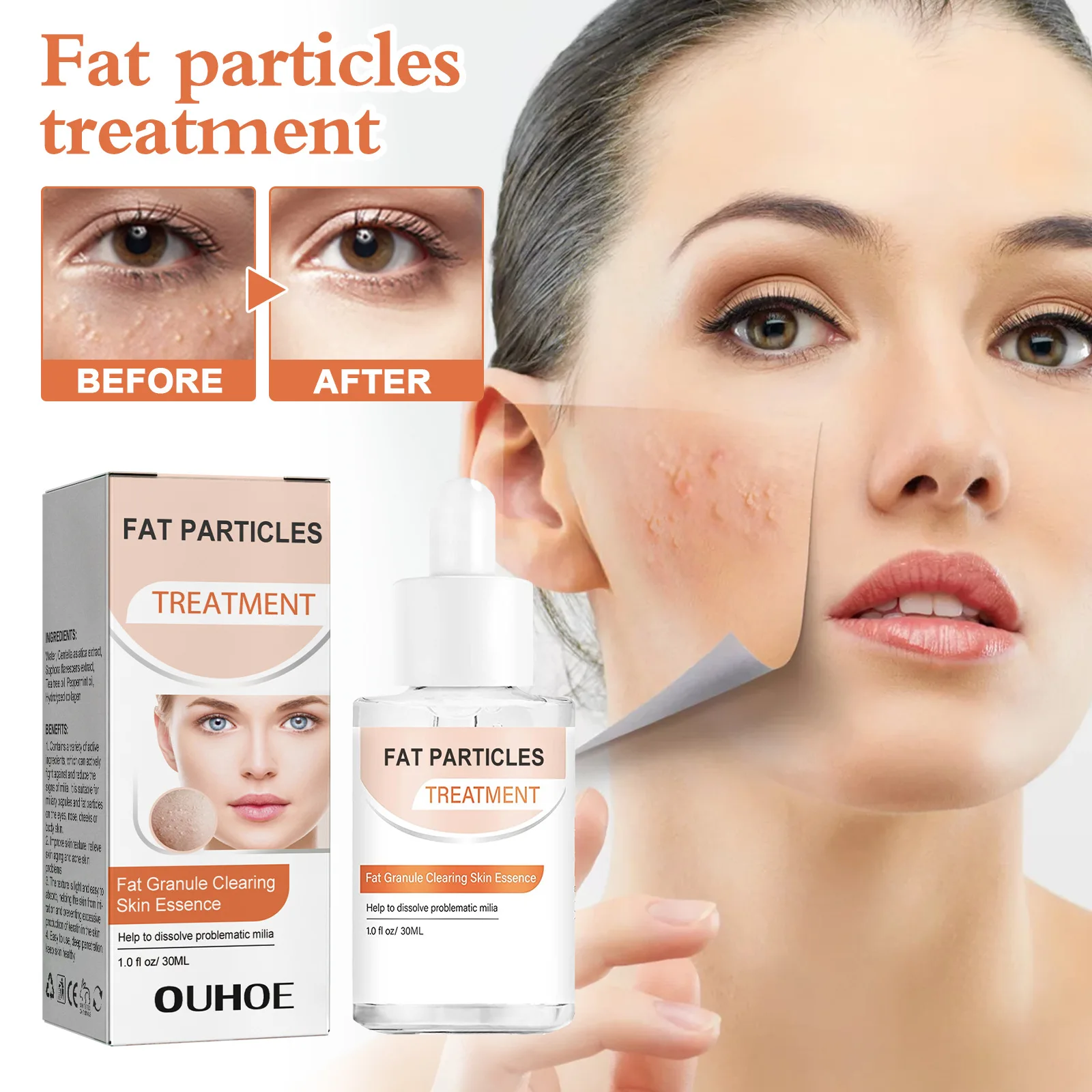 Fat Granules Removal Eye Serum Eye Acne Removal Repair Treatment Products Lifting Moisturizing Anti-Puffiness Wrinkle Skin Care