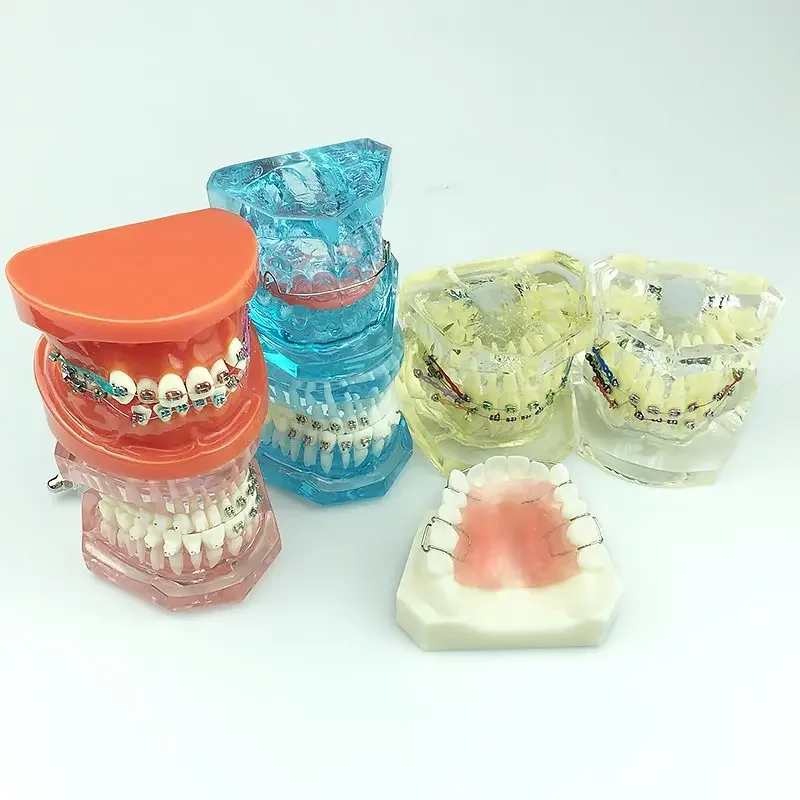 

Dental Orthodontic Teeth Model Transparent Teeth Orthodontic Model with Brackets