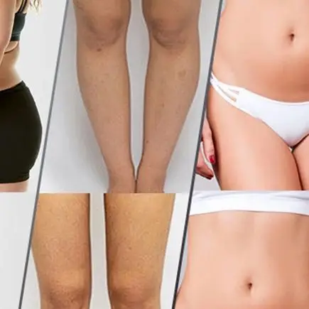 

4 in 1 Cellulite Massager Remover Body Sculpting Machine Cordless Electric Body Slimming Massage for Belly Waist Arm Leg Butt