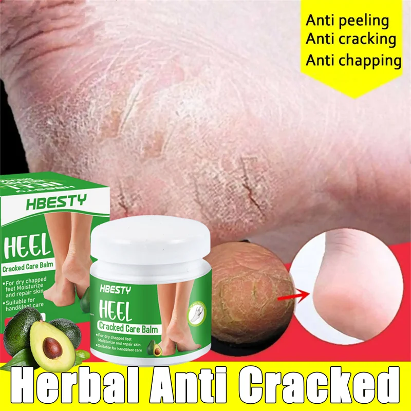 Herbal Anti Cracked Heel Treatment Cream Anti-Drying Removal Callus Dead Skin Balm Hand Foot Mositurizing Repair Skin Care Mask