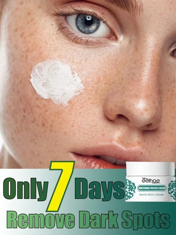 

Removal Dark Spots Whitening Freckle Cream Leaving skin looking brighter clearer and more luminous prevent future discoloration