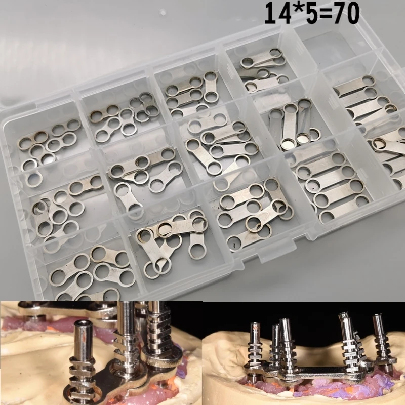 70Pcs Connecting Rods Dental Tools All on 4 Form Dental Prosthesis Metal Implant Supported Overdenture Bar 304 Stainless Steel