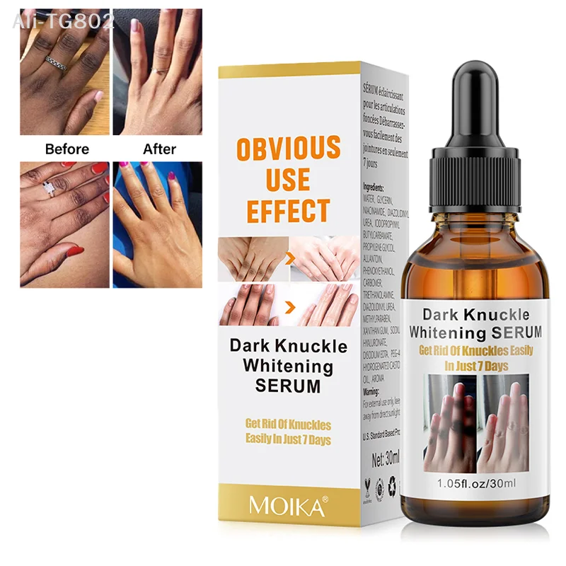 Dark Knuckles Whitening Serum Remover Get Rid Of Dark Knees Dark Knuckle Elbow Cream Moisturizing Brighten Skin Tone Care