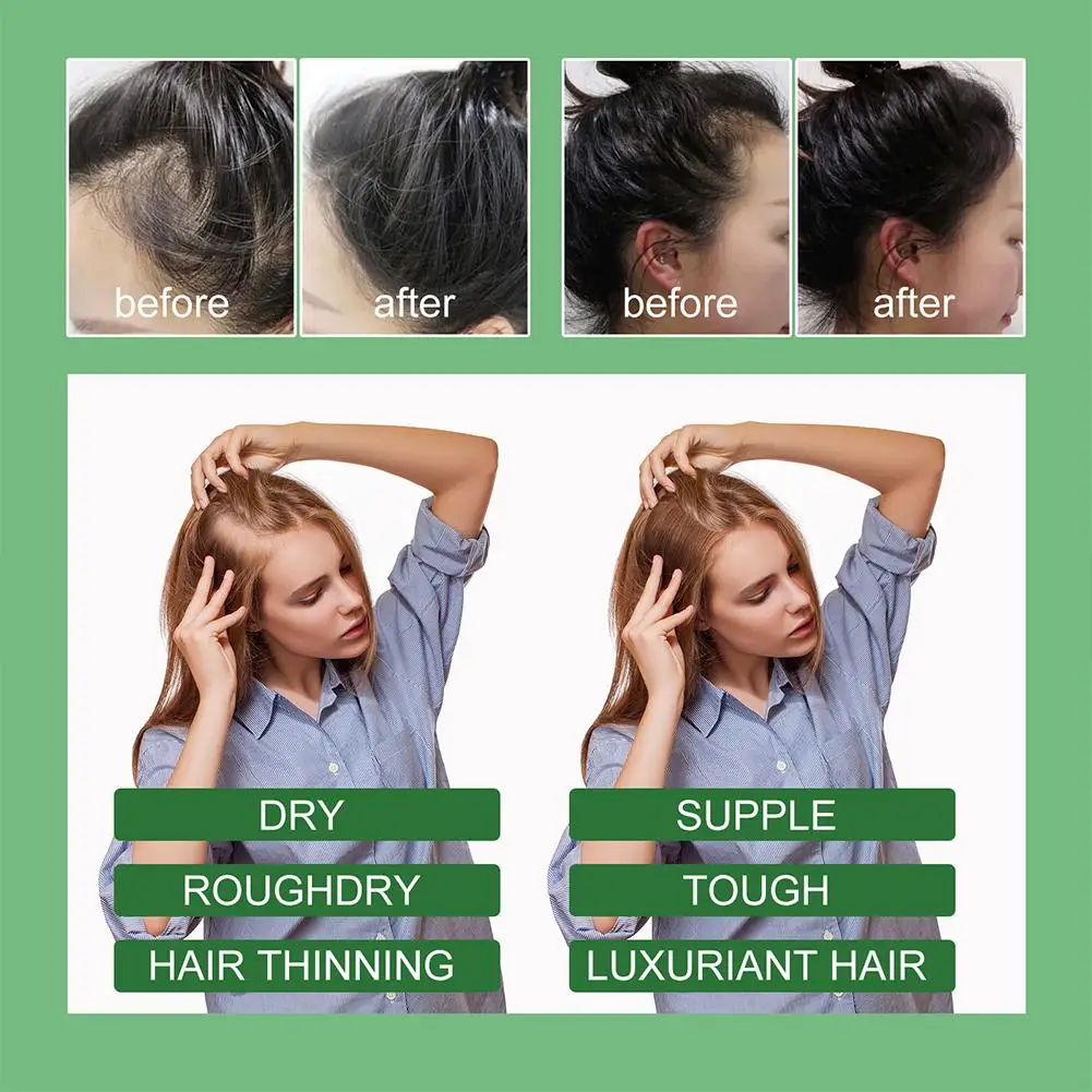 Ouhoe Rosemary Hair Care Serum Fast Growing Hair Essential Oil Beauty Hair Care Dense Regrowth Hair Promoting Regeneration Oil