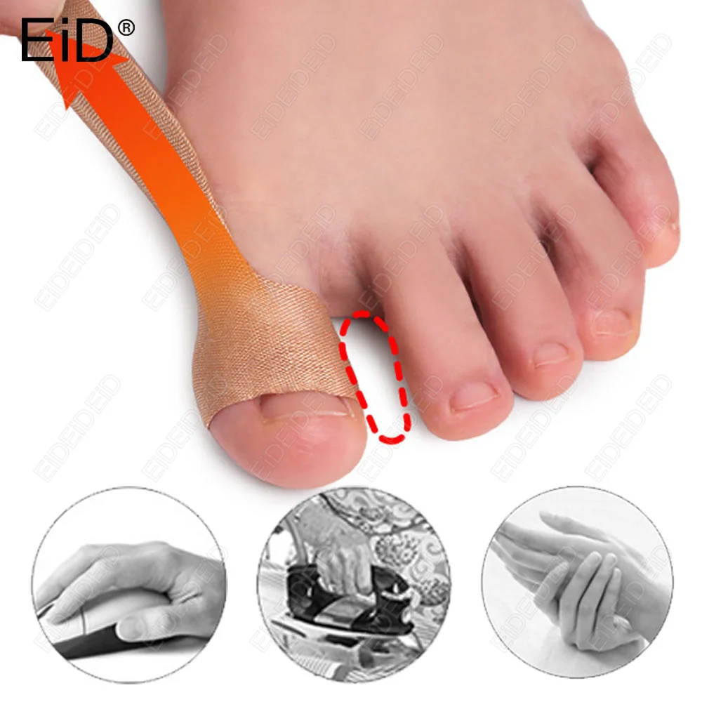 Thumb Valgus Correction Sticker wear resistant Foot Joint Protection Sticker for Daily Foot and Hand Care of Men and Women