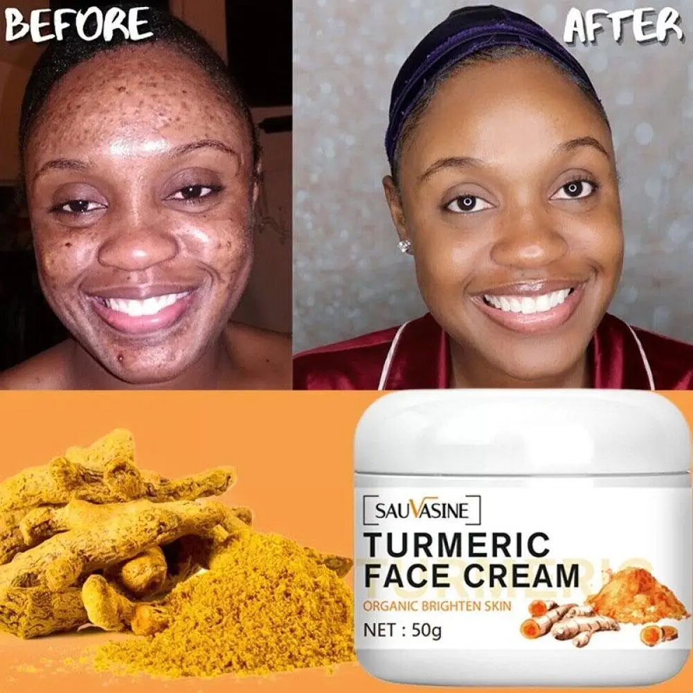 50g Turmeric Face Whitening Cream For Dark Skin Remove Acne Lighten Dark Spots Moisturizing Brightening Cream For Face Skin Q0i1