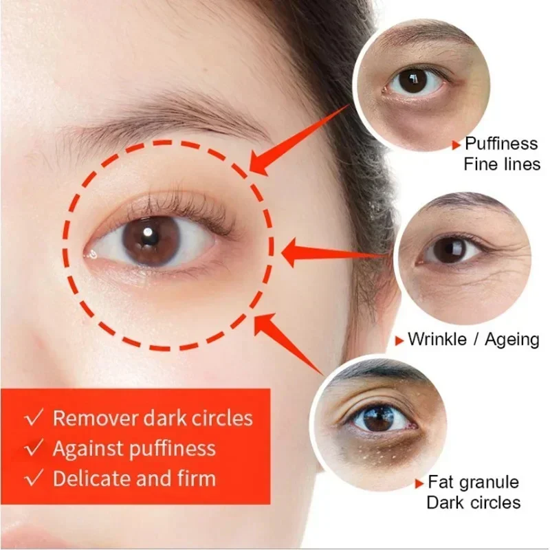 Instant Eye Bag Remove Eye Cream Anti Fat Particles Dark Circles Puffiness Fade Fine Lines Lift Brighten Korean Beauty Eye Care