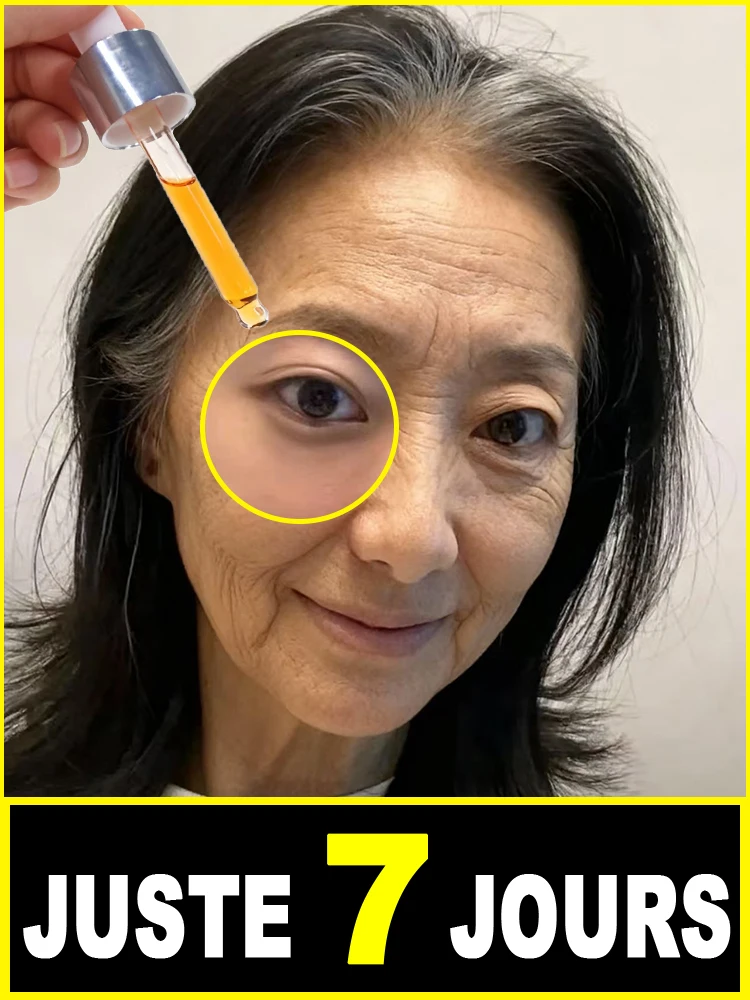 De rides,De des ridules,Radier la confiance