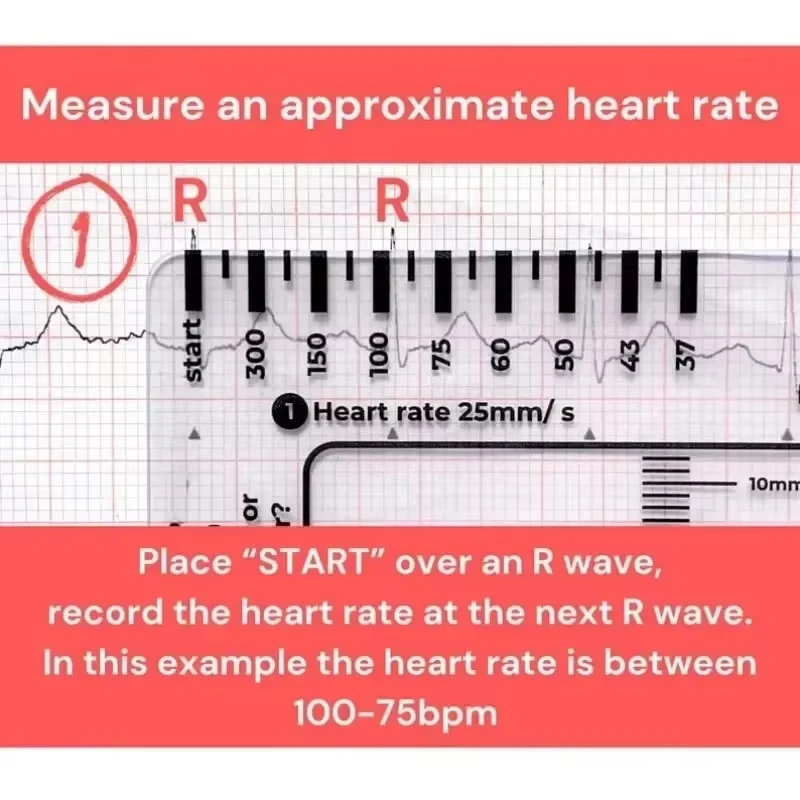 Ecg 7 Step Ruler 7 Step Scale for Ecg Observation Portable Transparent 7step Ruler Measurement Tool Ruler for Ecg Interpretation