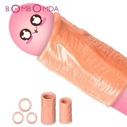 5PCS Foreskin Correction Penis Sleeve Cock Ring Glans Stimulate Sex Toys for Men Delay Ejaculation Screw Shape Two Sizes