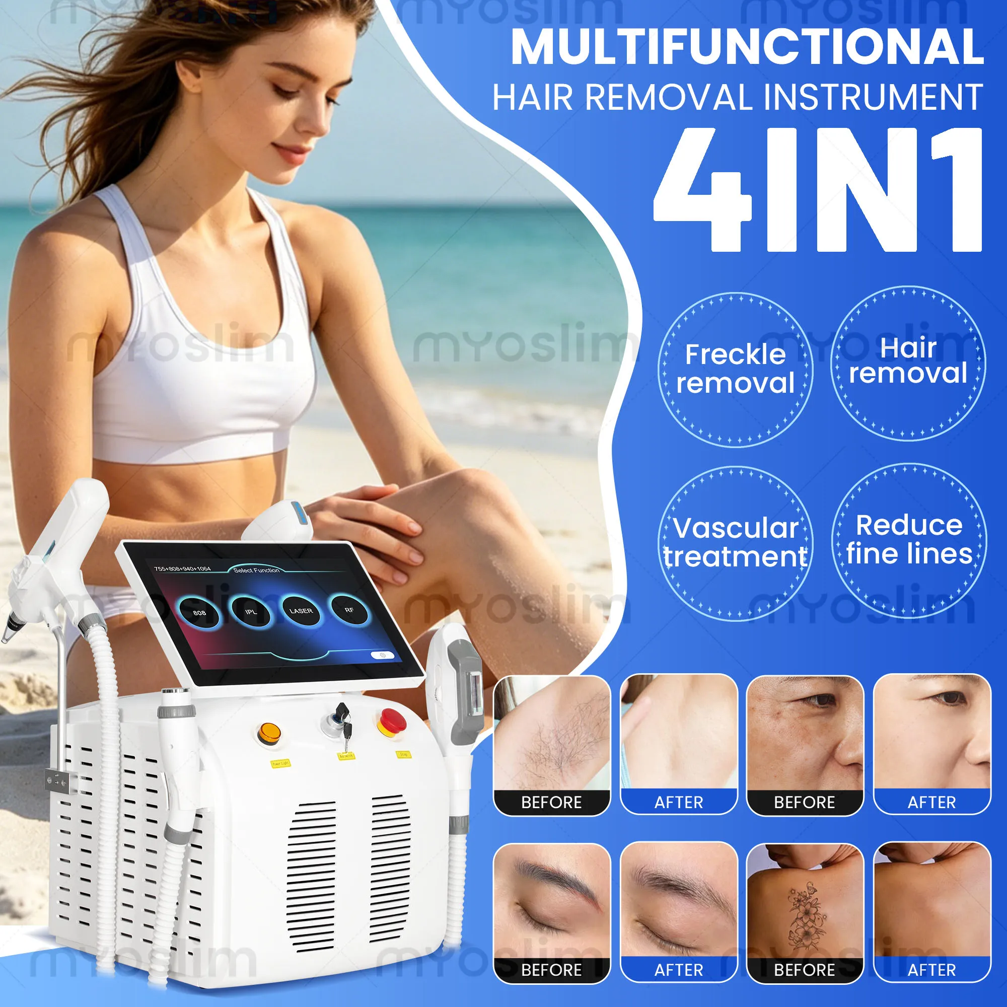 

Diode Hair Removal Laser 4 IN 1 5000W FAC 755 808 940 1064nm Soprano Painless Permanent Hair Removal CE Certified Beauty Device