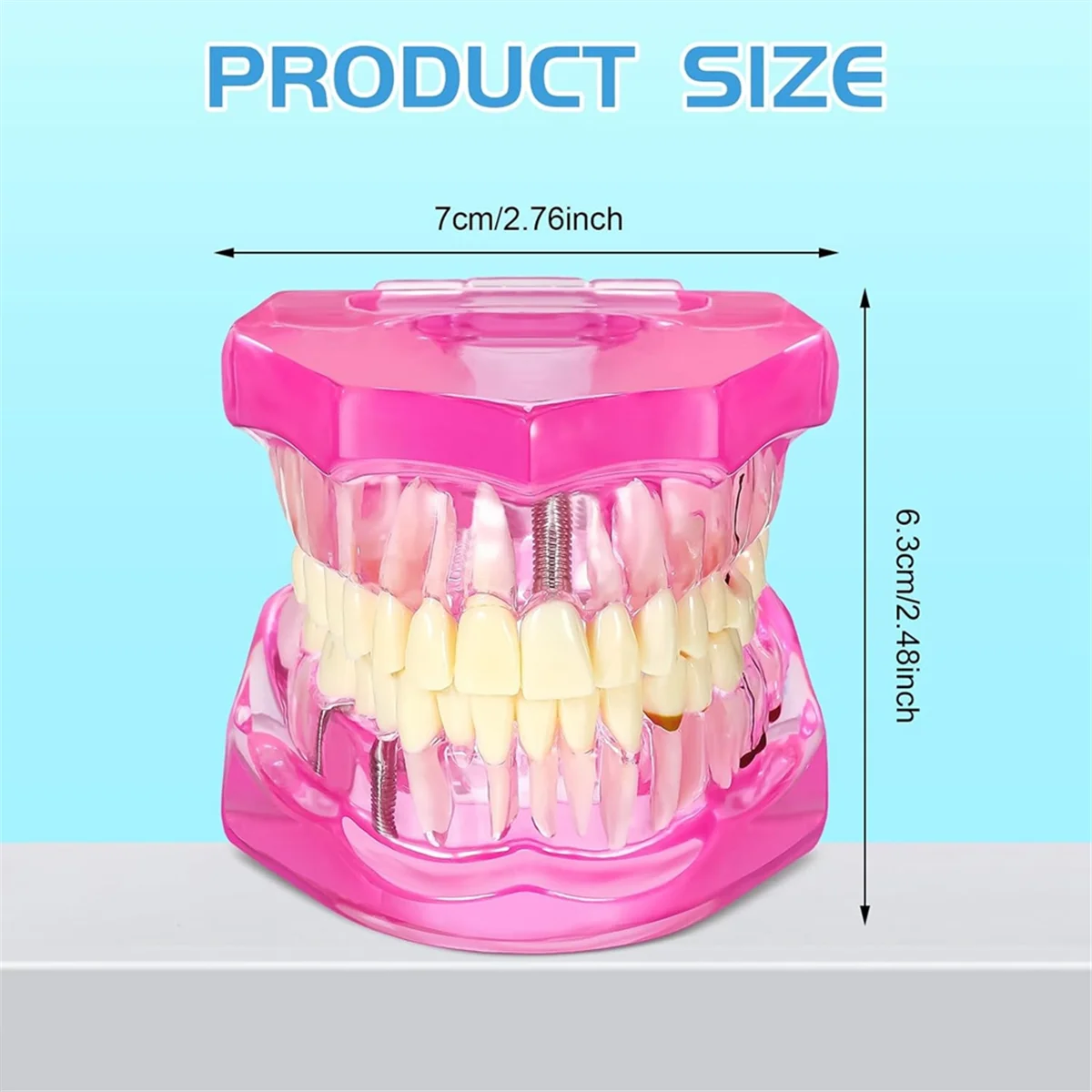 Disease Teeth Model Dental Typodonts Implant Teeth Model with Removable Teeth Pathological Demonstration (Pink,2 Pcs)