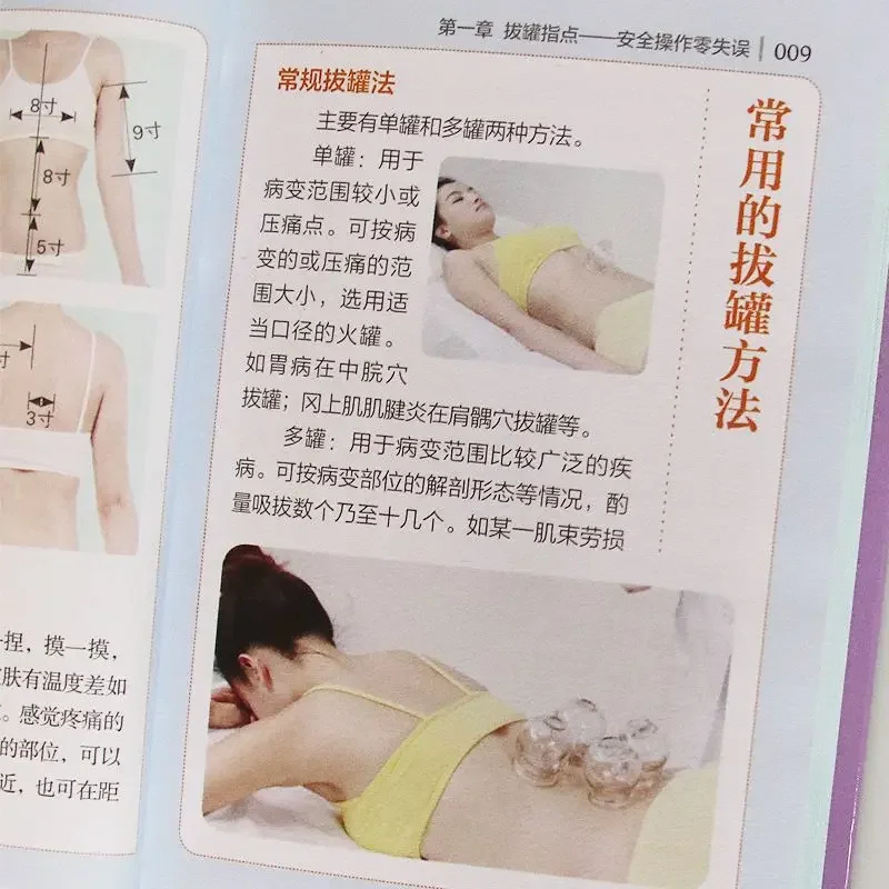 Symptomatic cupping TCM health book, illustration of human meridian acupuncture points, symptomatic cupping, zero basic learning