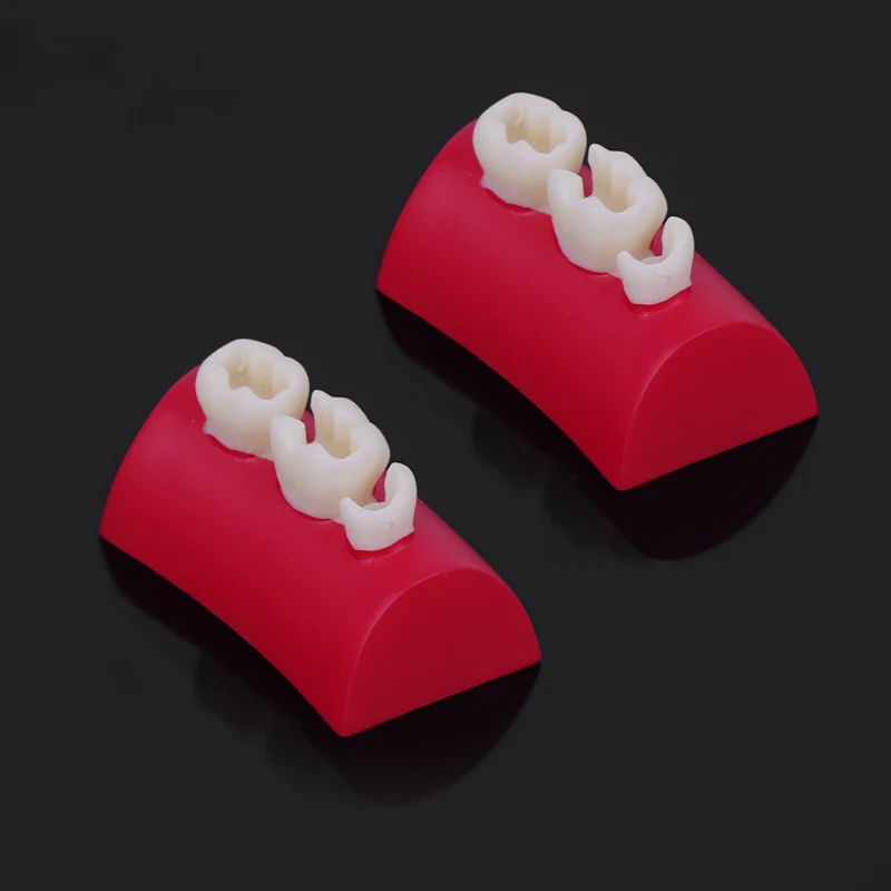 

1pc Dental Inlay Exercise Model Block Filling Exercise Typodont Resin Materials Oral Filling Model Dentistry Teaching Studying