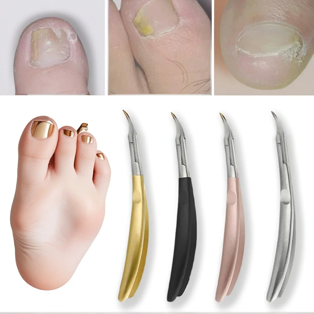 

Stainless Steel Ingrown Nail Clippers - Professional Cuticle Scissors & Toenail Nipper Pedicure Set