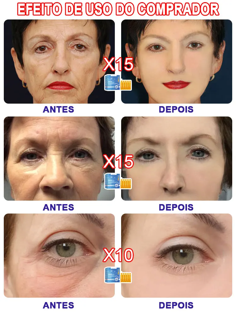 Wrinkles disappear, lift and tighten, repair sensitivity