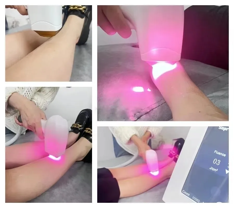 Diode Laser Epilator 3 Wavelength Painless 808nm Woman Hair Removal Machine 3500W Freezing Point Cooling System 755 808 1064NM