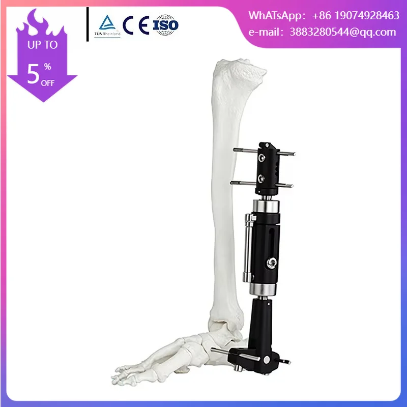 Orthopedic External Fixator,Dynamic Axial External Fixator (Ankle Joint Type),Factory Direct Supply