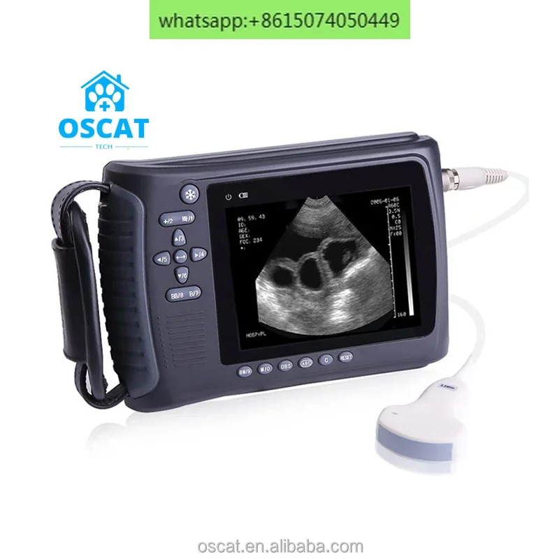 Portable all-digital black and white ultrasound machine clinic equipment