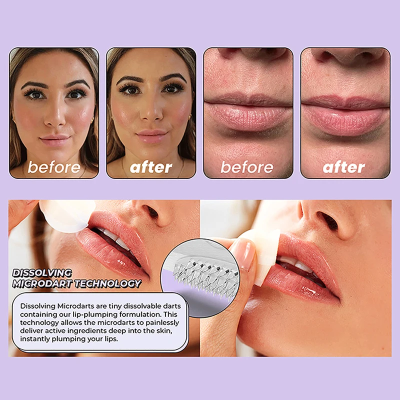 1 زوج حمض الهيالورونيك إبرة مجهرية الشفاه بقع لمكافحة التجاعيد تنعيم الفم ابتسامة رفع شركة الشفاه طبطب الشفاه العناية بالبشرة التصحيح