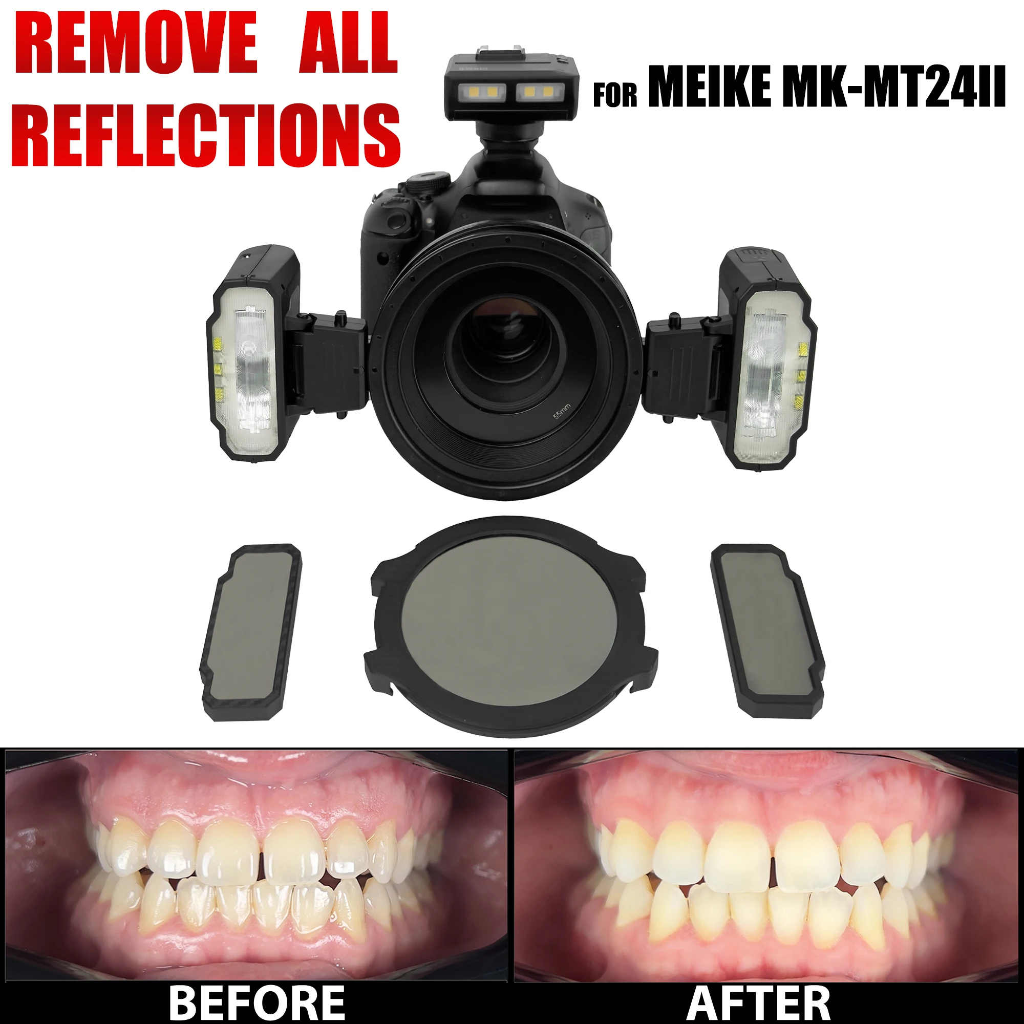 Cross Polarizing Lens For Dental Photography - No Glare, No Relfection Intraoral Photos For Dentist For MEIKE MK-MT24II Flash