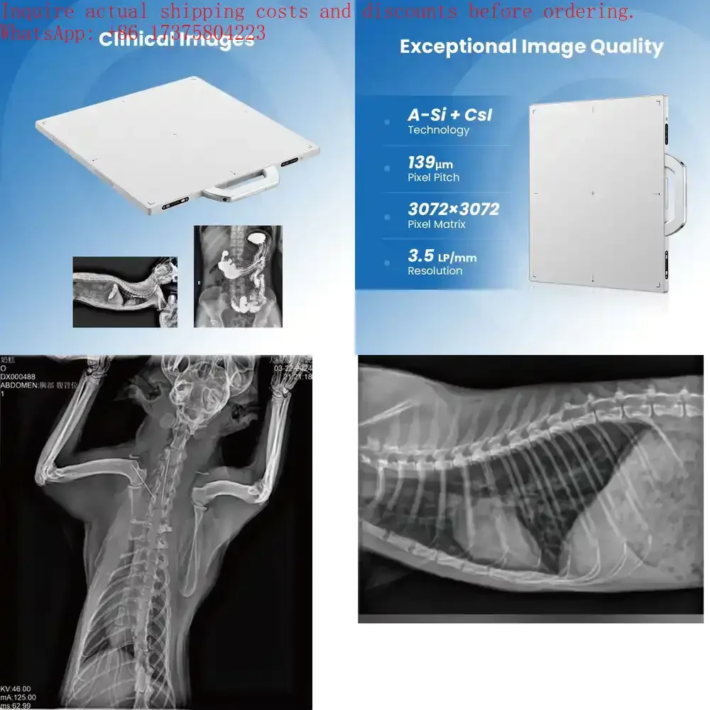 Wireless Flat Panel Detector for X-ray Systems 14x17 17x17 Inches High Resolution Digital Radiography Detector CE Certified 2