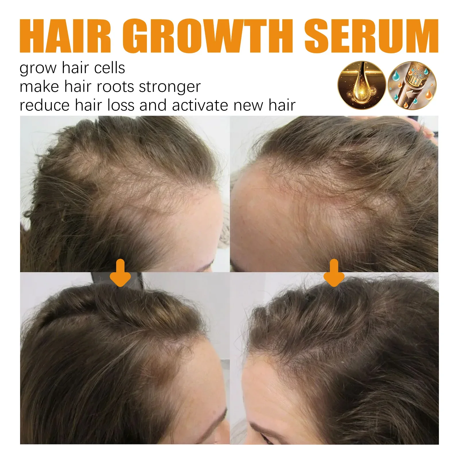 Huile essentielle de croissance rapide des cheveux pour hommes et femmes, prévention efficace de la perte de cheveux, sérum de traitement du cuir chevelu, croissance de la barbe