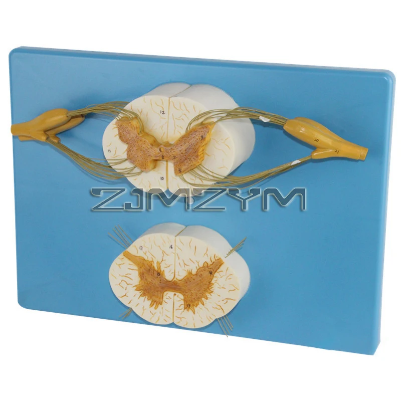 نموذج تشريحي للعمود الفقري البشري الموسع 5 مرات مع حبل العمود الفقري العصبي مع فروع الأعصاب وسائل طبية #4