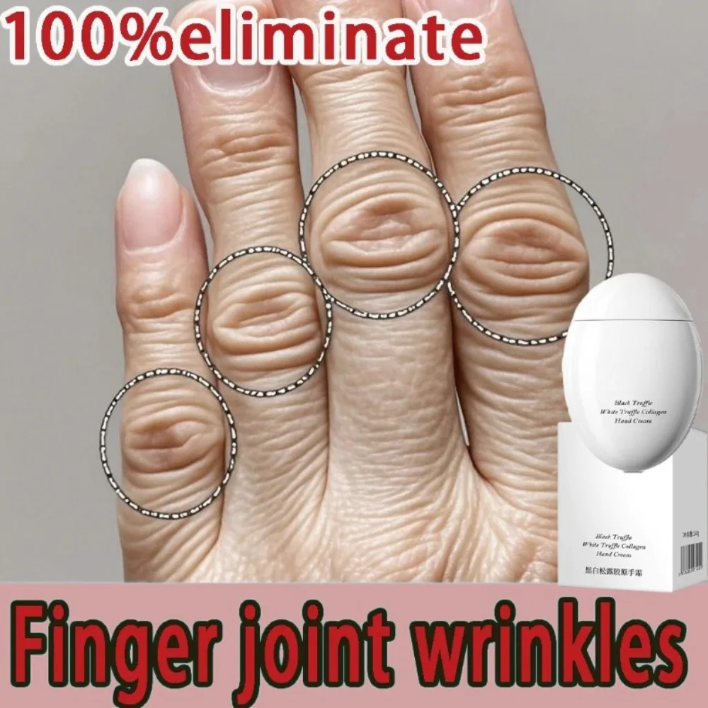 Handcreme zur Entfernung von Falten auf Fingergelenken, zur Entfernung von Handfalten und zur Reduzierung der Gelenkräusheit und Schwarzheit
